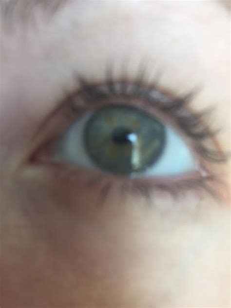 Can two brown eyes make blue eyes?